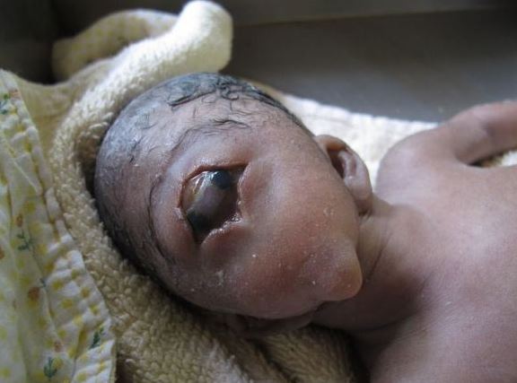 The world is in turmoil as a newborn mutant baby with a one-eyed appearance resembling a creature sparks global concerns. (video)