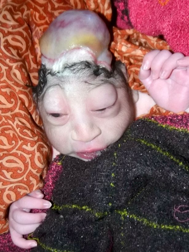 The mother was shocked when she saw the child looking like an alien